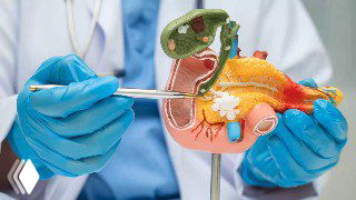 Анатомическая модель желчного пузыря в руках врача в перчатках с указкой; иллюстрация для ролика о функциях, перегибе, взвеси и удалении желчного пузыря