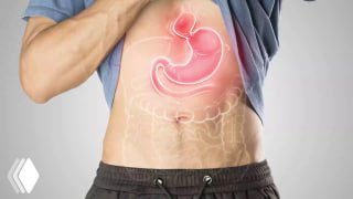 Иллюстрация живота с подсвеченным желудком и пищеводом, показывающая локализацию грыжи пищеводного отверстия диафрагмы.