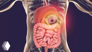 Иллюстрация ЖКТ: прозрачный силуэт человека с подчёркнутым желудком, двенадцатиперстной кишкой и кишечником в контексте материала о язве.