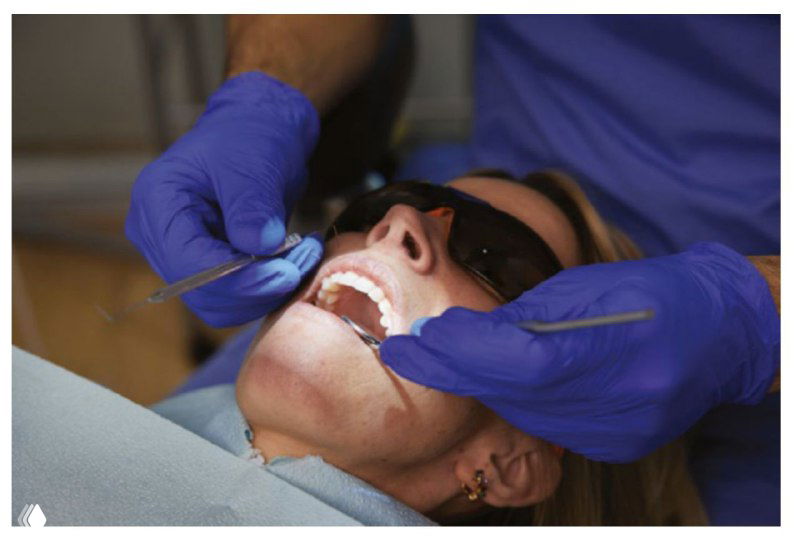 Пациентка в стоматологическом кресле с защитными очками, врач в перчатках исследует ротовую полость зеркалом и инструментом в операционной обстановке.