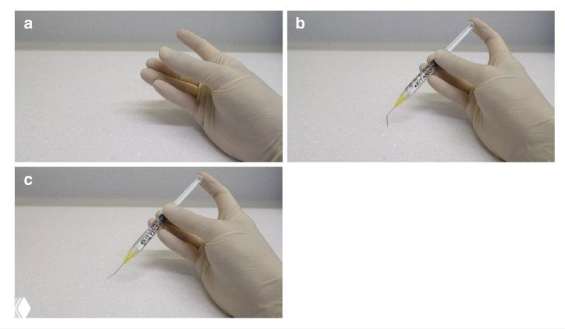 Рука в стерильной перчатке держит шприц в нейтральном положении и показывает ориентацию кончика иглы для верхних и нижних зубов под микроскопом.