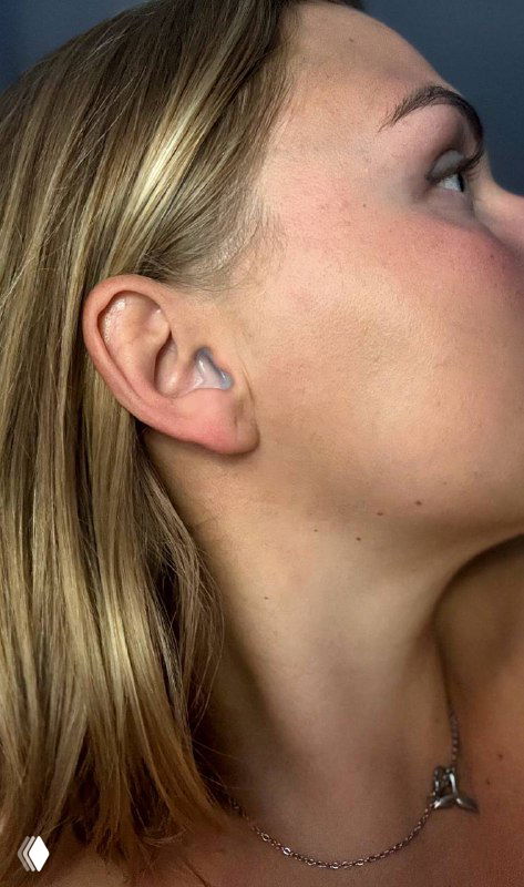 Женское ухо с вставленной индивидуальной берушей — показано, как изделие сидит в слуховом проходе и выглядит при носке