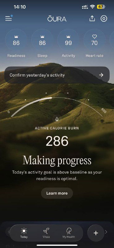 Кольцо Oura и иллюзия «всё нормально»