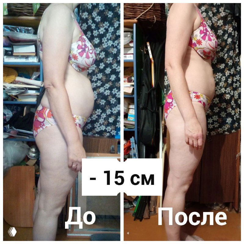 Коллаж «До/После»: боковой профиль женщины в купальнике, видна разница объёма живота и талии; на изображении подпись «-15 см».
