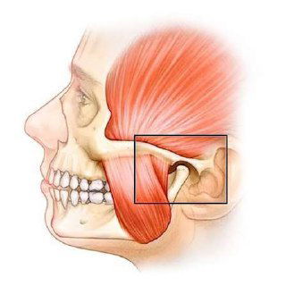 Медицинская схема височно‑нижнечелюстного сустава и жевательных мышц в профиль, показывающая расположение сустава рядом с ухом и прилегающие связки и мышцы лица.