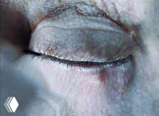 Крупный план закрытого века и морщинистой кожи на сюрреалистичной иллюстрации — акцент на текстуре лица и мягком освещении, заметен логотип в углу.