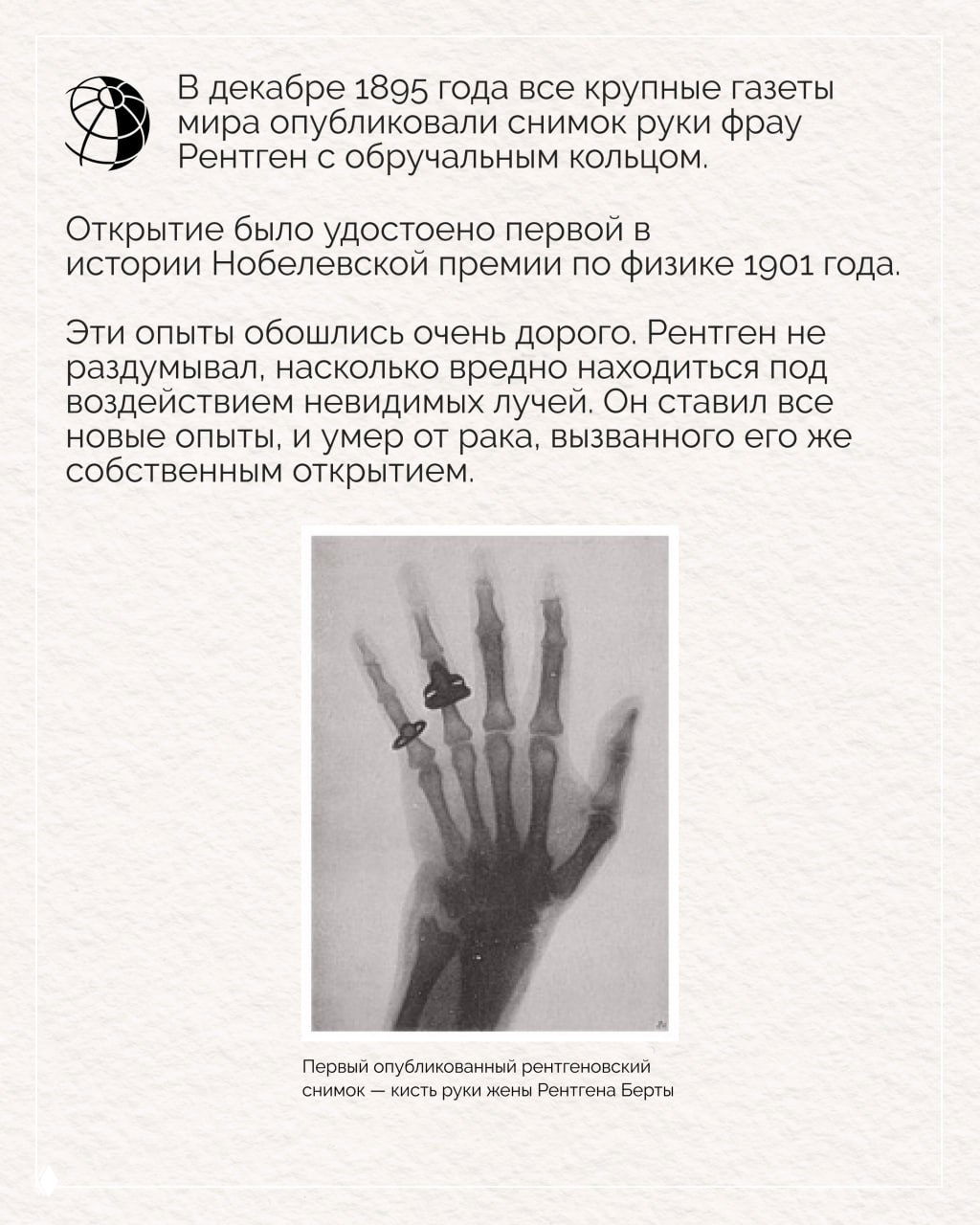 Ранний рентгеновский снимок кисти руки с видимыми костями и обручальным кольцом на пальце в чёрно‑белой гамме.