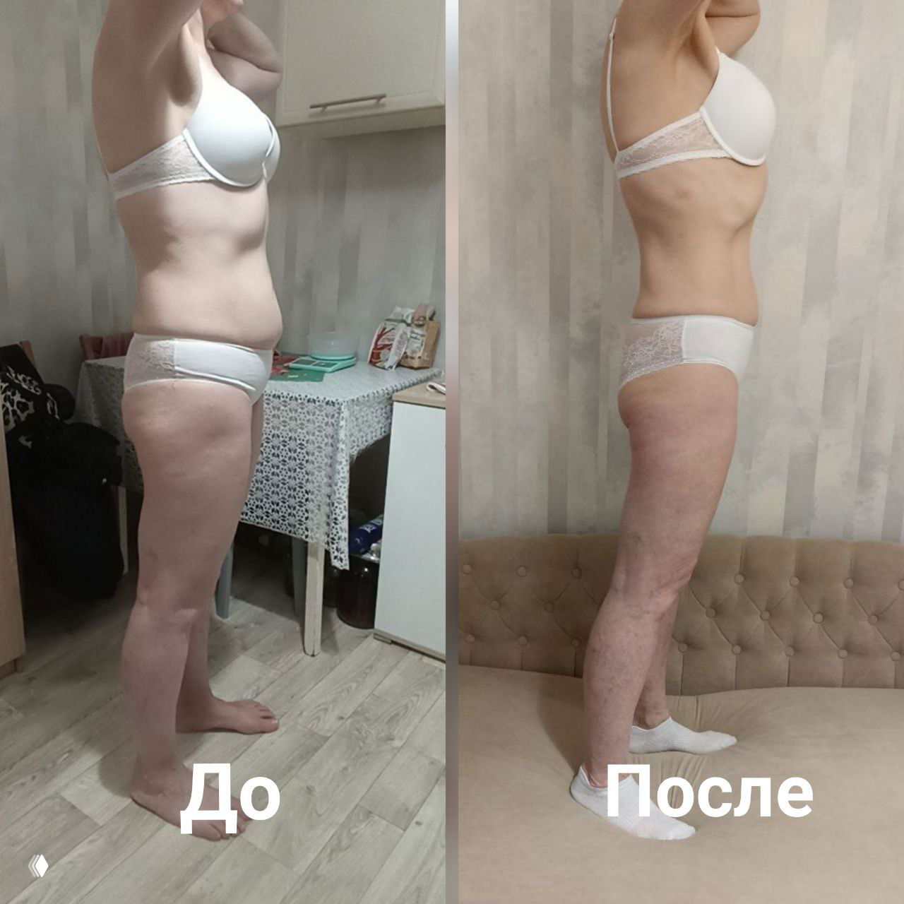 Профильный кадр «до/после»: боковой вид женщины в белом белье, заметно уменьшение брюшного объёма и боковых валиков, улучшился тонус ног после марафона.